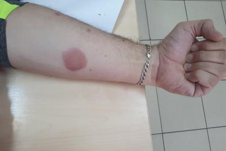 Три популярных средства народной медицины, которые вредят здоровью